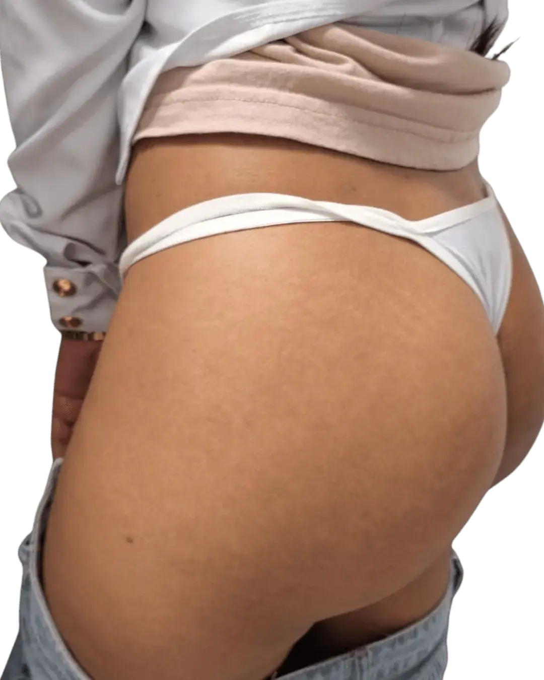 Tratamento de Camuflagem de Estrias